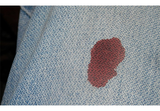 Пятно крови на джинсах